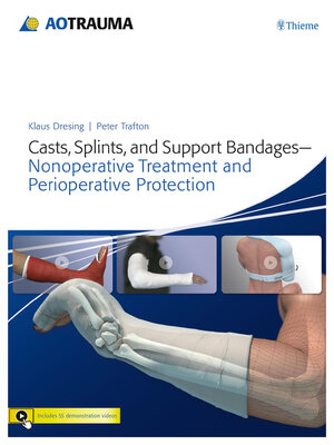 cover image of Casts, Splints, and Support Bandages